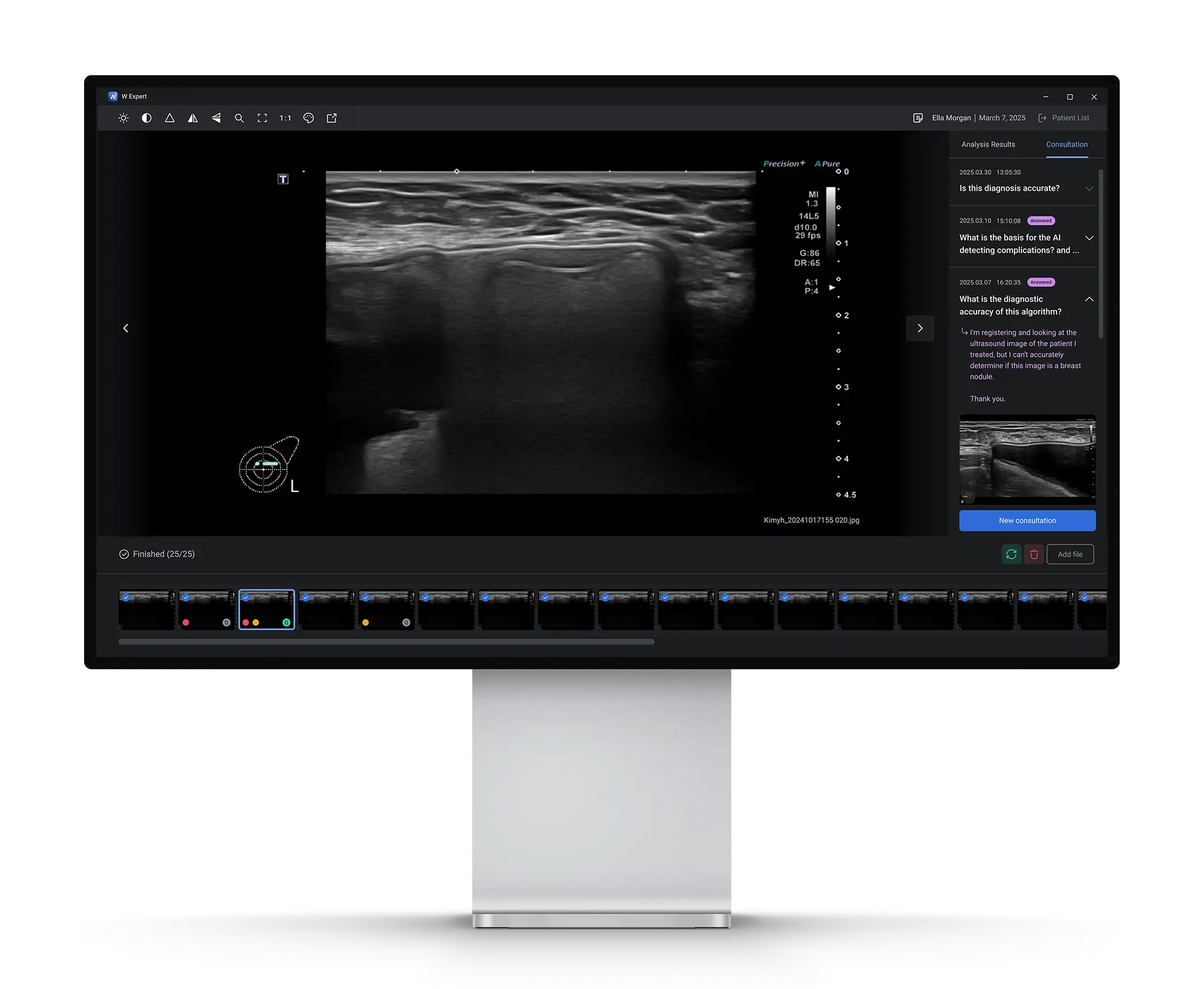 Detailed Analysis and Expert Consultation